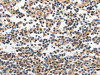 The image on the left is immunohistochemistry of paraffin-embedded Human tonsil tissue using CSB-PA204522 (INHA Antibody) at dilution 1/120, on the right is treated with fusion protein. (Original magnification: ×200)