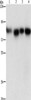 Gel: 8%SDS-PAGE, Lysate: 40 μg, Lane 1-4: Hela cells, 231 cells, hepG2 cells, Raji cells, Primary antibody: CSB-PA240533 (MAD1L1 Antibody) at dilution 1/500, Secondary antibody: Goat anti rabbit IgG at 1/8000 dilution, Exposure time: 5 seconds