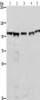 Gel: 10%SDS-PAGE, Lysate: 40 μg, Lane 1-5: 293T cells, A549 cells, Raji cells, K562 cells, NIH/3T3 cells, Primary antibody: CSB-PA178919 (MCM6 Antibody) at dilution 1/433.3, Secondary antibody: Goat anti rabbit IgG at 1/8000 dilution, Exposure time: 5 seconds