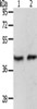 Gel: 10%SDS-PAGE, Lysate: 40 μg, Lane 1-2: MCF7 cells, mouse brain tissue, Primary antibody: CSB-PA919764 (PAX8 Antibody) at dilution 1/250, Secondary antibody: Goat anti rabbit IgG at 1/8000 dilution, Exposure time: 2 minutes