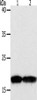 Gel: 10+12%SDS-PAGE, Lysate: 50 μg, Lane 1-2: Jurkat cells, hela cells, Primary antibody: CSB-PA592469 (PDCD6 Antibody) at dilution 1/200, Secondary antibody: Goat anti rabbit IgG at 1/8000 dilution, Exposure time: 1 minute