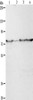 Gel: 8%SDS-PAGE, Lysate: 40 μg, Lane 1-4: Hela cells, human fetal liver tissue, 231 cells, A549 cells, Primary antibody: CSB-PA548387 (PEG10 Antibody) at dilution 1/200, Secondary antibody: Goat anti rabbit IgG at 1/8000 dilution, Exposure time: 1 minute