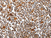 The image on the left is immunohistochemistry of paraffin-embedded Human tonsil tissue using CSB-PA797351 (PIK3R1 Antibody) at dilution 1/30, on the right is treated with fusion protein. (Original magnification: ×200)