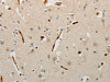 The image on the left is immunohistochemistry of paraffin-embedded Human brain tissue using CSB-PA205557 (PLAU Antibody) at dilution 1/10, on the right is treated with fusion protein. (Original magnification: ×200)