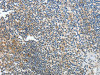 The image on the left is immunohistochemistry of paraffin-embedded Human tonsil tissue using CSB-PA686209 (PRMT2 Antibody) at dilution 1/20, on the right is treated with fusion protein. (Original magnification: ×200)