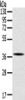 Gel: 8%SDS-PAGE, Lysate: 40 μg, Lane: A375 cells, Primary antibody: CSB-PA785325 (SPARC Antibody) at dilution 1/400, Secondary antibody: Goat anti rabbit IgG at 1/8000 dilution, Exposure time: 5 seconds