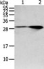 Gel: 12%SDS-PAGE, Lysate: 40 μg, Lane 1-2: Mouse brain and human fetal brain tissue, Primary antibody: CSB-PA976302 (SPIN4 Antibody) at dilution 1/200 dilution, Secondary antibody: Goat anti rabbit IgG at 1/8000 dilution, Exposure time: 1 minute