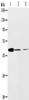 Gel: 10%SDS-PAGE, Lysate: 40 μg, Lane 1-3: NIH/3T3 cells, SKOV3 cells, human ovarian cancer tissue, Primary antibody: CSB-PA591967 (ABCE1 Antibody) at dilution 1/450, Secondary antibody: Goat anti rabbit IgG at 1/8000 dilution, Exposure time: 2 minutes