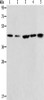 Gel: 10%SDS-PAGE, Lysate: 40 μg, Lane 1-5: Hela cells, A549 cells, NIH/3T3 cells, A172 cells, human liver cancer tissue, Primary antibody: CSB-PA614749 (ACAA2 Antibody) at dilution 1/225, Secondary antibody: Goat anti rabbit IgG at 1/8000 dilution, Exposure time: 20 seconds