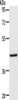 Gel: 10%SDS-PAGE, Lysate: 40 μg, Lane: Rat kidney tissue, Primary antibody: CSB-PA129011 (ACADS Antibody) at dilution 1/350, Secondary antibody: Goat anti rabbit IgG at 1/8000 dilution, Exposure time: 90 seconds