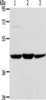 Gel: 10%SDS-PAGE, Lysate: 40 μg, Lane 1-3: Human liver cancer tissue, rat kidney tissue, human fetal liver tissue, Primary antibody: CSB-PA957686 (ACADS Antibody) at dilution 1/400, Secondary antibody: Goat anti rabbit IgG at 1/8000 dilution, Exposure time: 90 seconds