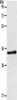 Gel: 10%SDS-PAGE, Lysate: 40 μg, Lane: Mouse kidney tissue, Primary antibody: CSB-PA577006 (ACY3 Antibody) at dilution 1/500, Secondary antibody: Goat anti rabbit IgG at 1/8000 dilution, Exposure time: 5 seconds