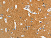 The image on the left is immunohistochemistry of paraffin-embedded Human brain tissue using CSB-PA436650 (ADD2 Antibody) at dilution 1/15, on the right is treated with fusion protein. (Original magnification: ×200)