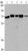 Gel: 8%SDS-PAGE, Lysate: 40 μg, Lane 1-5: A172 cells, Hela cells, 293T cells, K562 cells, human testis tissue, Primary antibody: CSB-PA015892 (AGFG1 Antibody) at dilution 1/727, Secondary antibody: Goat anti rabbit IgG at 1/8000 dilution, Exposure time: 40 seconds