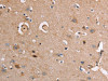 The image on the left is immunohistochemistry of paraffin-embedded Human brain tissue using CSB-PA298726 (AKR1B10 Antibody) at dilution 1/20, on the right is treated with fusion protein. (Original magnification: ×200)