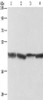 Gel: 10%SDS-PAGE, Lysate: 40 μg, Lane 1-4: human fetal liver tissue, Human liver cancer tissue, mouse liver tissue, human hepatocellular carcinoma tissue, Primary antibody: CSB-PA233146 (ADH1A Antibody) at dilution 1/250, Secondary antibody: Goat anti rabbit IgG at 1/8000 dilution, Exposure time: 10 seconds