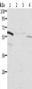 Gel: 10%SDS-PAGE, Lysate: 40 μg, Lane 1-4: Rat kidney tissue, human fetal kidney tissue, Jurkat cells, K562 cells, Primary antibody: CSB-PA280938 (ALDH6A1 Antibody) at dilution 1/450, Secondary antibody: Goat anti rabbit IgG at 1/8000 dilution, Exposure time: 20 seconds