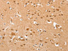 The image on the left is immunohistochemistry of paraffin-embedded Human brain tissue using CSB-PA241286 (AHSG Antibody) at dilution 1/60, on the right is treated with fusion protein. (Original magnification: ×200)