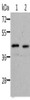 Gel: 10%SDS-PAGE, Lysate: 40 μg, Lane 1-2: Jurkat cells, human fetal kidney tissue, Primary antibody: CSB-PA076874 (NIF3L1 Antibody) at dilution 1/500, Secondary antibody: Goat anti rabbit IgG at 1/8000 dilution, Exposure time: 2 minutes