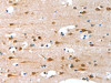The image on the left is immunohistochemistry of paraffin-embedded Human brain tissue using CSB-PA052274 (ALS2CR11 Antibody) at dilution 1/30, on the right is treated with fusion protein. (Original magnification: ×200)