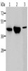 Gel: 10%SDS-PAGE, Lysate: 40 μg, Lane 1-3: Mouse kidney tissue, human normal kidney tissue, K562 cells, Primary antibody: CSB-PA616041 (ACY1 Antibody) at dilution 1/250, Secondary antibody: Goat anti rabbit IgG at 1/8000 dilution, Exposure time: 2 minutes