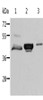 Gel: 10%SDS-PAGE, Lysate: 40 μg, Lane 1-3: Mouse kidney tissue, human normal kidney tissue, K562 cells, Primary antibody: CSB-PA287728 (ACY1 Antibody) at dilution 1/200, Secondary antibody: Goat anti rabbit IgG at 1/8000 dilution, Exposure time: 1 minute