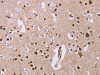 The image on the left is immunohistochemistry of paraffin-embedded Human brain tissue using CSB-PA168510 (ANLN Antibody) at dilution 1/20, on the right is treated with fusion protein. (Original magnification: ×200)