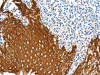 The image on the left is immunohistochemistry of paraffin-embedded Human tonsil tissue using CSB-PA579076 (ANXA9 Antibody) at dilution 1/20, on the right is treated with fusion protein. (Original magnification: ×200)