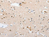 The image on the left is immunohistochemistry of paraffin-embedded Human brain tissue using CSB-PA227449 (APPBP2 Antibody) at dilution 1/30, on the right is treated with fusion protein. (Original magnification: ×200)