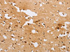 The image on the left is immunohistochemistry of paraffin-embedded Human brain tissue using CSB-PA786075 (ACTR2 Antibody) at dilution 1/40, on the right is treated with fusion protein. (Original magnification: ×200)