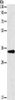 Gel: 10%SDS-PAGE, Lysate: 40 μg, Lane: Mouse liver tissue, Primary antibody: CSB-PA931421 (GNMT Antibody) at dilution 1/200, Secondary antibody: Goat anti rabbit IgG at 1/8000 dilution, Exposure time: 5 seconds