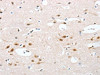 The image on the left is immunohistochemistry of paraffin-embedded Human brain tissue using CSB-PA945911 (UBQLN1 Antibody) at dilution 1/20, on the right is treated with fusion protein. (Original magnification: ×200)