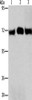 Gel: 8%SDS-PAGE, Lysate: 40 μg, Lane 1-3: Hela cells, A549 cells, human liver cancer tissue, Primary antibody: CSB-PA233350 (RPN1 Antibody) at dilution 1/350, Secondary antibody: Goat anti rabbit IgG at 1/8000 dilution, Exposure time: 30 seconds