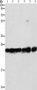 Gel: 10%SDS-PAGE, Lysate: 40 μg, Lane 1-6: Mouse liver tissue, Mouse brain tissue, 293T cells, A549 cells, A431 cells, PC3 cells, Primary antibody: CSB-PA209031 (SIGMAR1 Antibody) at dilution 1/310, Secondary antibody: Goat anti rabbit IgG at 1/8000 dilution, Exposure time: 1 second