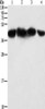 Gel: 10%SDS-PAGE, Lysate: 40 μg, Lane 1-4: HepG2 cells, 293T cells, hela cells, NIH/3T3 cells, Primary antibody: CSB-PA145596 (PGK2 Antibody) at dilution 1/600, Secondary antibody: Goat anti rabbit IgG at 1/8000 dilution, Exposure time: 5 seconds