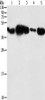 Gel: 10%SDS-PAGE, Lysate: 40 μg, Lane 1-5: HepG2 cells, human fetal placenta tissue, 293T cells, human testis tissue, NIH/3T3 cells, Primary antibody: CSB-PA191316 (PGK2 Antibody) at dilution 1/600, Secondary antibody: Goat anti rabbit IgG at 1/8000 dilution, Exposure time: 5 seconds