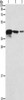 Gel: 10%SDS-PAGE, Lysate: 40 μg, Lane 1-3: Human endometrial carcinoma tissue, A172 cells, U937 cells, Primary antibody: CSB-PA146937 (TWF2 Antibody) at dilution 1/800, Secondary antibody: Goat anti rabbit IgG at 1/8000 dilution, Exposure time: 20 seconds