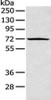 Gel: 8%SDS-PAGE, Lysate: 40 μg, Lane: A431 cell, Primary antibody: CSB-PA275027 (PLK3 Antibody) at dilution 1/200 dilution, Secondary antibody: Goat anti rabbit IgG at 1/8000 dilution, Exposure time: 1 minute