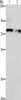 Gel: 10%SDS-PAGE, Lysate: 40 μg, Lane 1-2: A549 cells, 231 cells, Primary antibody: CSB-PA299370 (NEK11 Antibody) at dilution 1/1000, Secondary antibody: Goat anti rabbit IgG at 1/8000 dilution, Exposure time: 1 minute