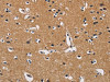The image on the left is immunohistochemistry of paraffin-embedded Human brain tissue using CSB-PA090179 (CBY1 Antibody) at dilution 1/60, on the right is treated with fusion protein. (Original magnification: ×200)