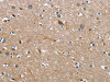 The image on the left is immunohistochemistry of paraffin-embedded Human brain tissue using CSB-PA068175 (CBY1 Antibody) at dilution 1/60, on the right is treated with fusion protein. (Original magnification: ×200)