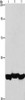 Gel: 10%SDS-PAGE, Lysate: 40 μg, Lane 1-3: A549 cells, mouse liver tissue, hepG2 cells, Primary antibody: CSB-PA905158 (PGK1 Antibody) at dilution 1/1000, Secondary antibody: Goat anti rabbit IgG at 1/8000 dilution, Exposure time: 20 seconds