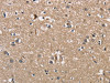 The image on the left is immunohistochemistry of paraffin-embedded Human brain tissue using CSB-PA547426 (PGK1 Antibody) at dilution 1/40, on the right is treated with fusion protein. (Original magnification: ×200)