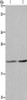Gel: 8%SDS-PAGE, Lysate: 40 μg, Lane 1-2: A549 cells, Hela cells, Primary antibody: CSB-PA512932 (ASF1A Antibody) at dilution 1/1200, Secondary antibody: Goat anti rabbit IgG at 1/8000 dilution, Exposure time: 20 seconds