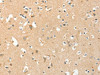 The image on the left is immunohistochemistry of paraffin-embedded Human brain tissue using CSB-PA179815 (AANAT Antibody) at dilution 1/40, on the right is treated with fusion protein. (Original magnification: ×200)