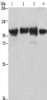 Gel: 6%SDS-PAGE, Lysate: 40 μg, Lane 1-4: Lovo cells, mouse kidney tissue, 231 cells, hepG2 cells, Primary antibody: CSB-PA070925 (ACTN4 Antibody) at dilution 1/485, Secondary antibody: Goat anti rabbit IgG at 1/8000 dilution, Exposure time: 10 seconds