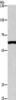 Gel: 6%SDS-PAGE, Lysate: 40 μg, Lane: Mouse testis tissue, Primary antibody: CSB-PA617569 (ARMCX2 Antibody) at dilution 1/425, Secondary antibody: Goat anti rabbit IgG at 1/8000 dilution, Exposure time: 40 seconds