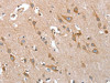 The image on the left is immunohistochemistry of paraffin-embedded Human brain tissue using CSB-PA948343 (TP53BP2 Antibody) at dilution 1/35, on the right is treated with fusion protein. (Original magnification: ×200)