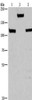 Gel: 10%SDS-PAGE, Lysate: 40 μg, Lane 1-3: Mouse kidney tissue, 293T cells, 231 cells, Primary antibody: CSB-PA948343 (TP53BP2 Antibody) at dilution 1/375, Secondary antibody: Goat anti rabbit IgG at 1/8000 dilution, Exposure time: 30 seconds