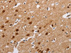 The image on the left is immunohistochemistry of paraffin-embedded Human brain tissue using CSB-PA936340 (ATXN1 Antibody) at dilution 1/40, on the right is treated with fusion protein. (Original magnification: ×200)